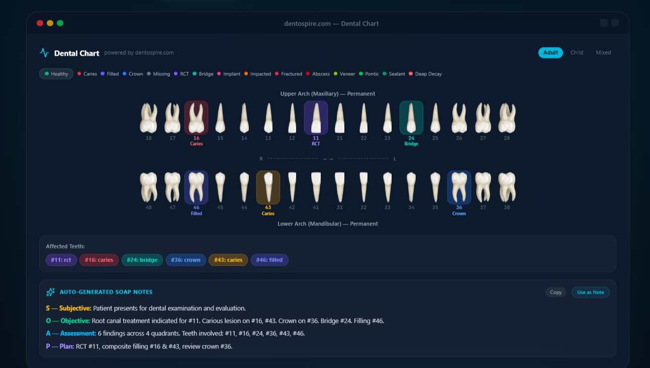 Dentospire AI dental chart with auto-generated SOAP notes