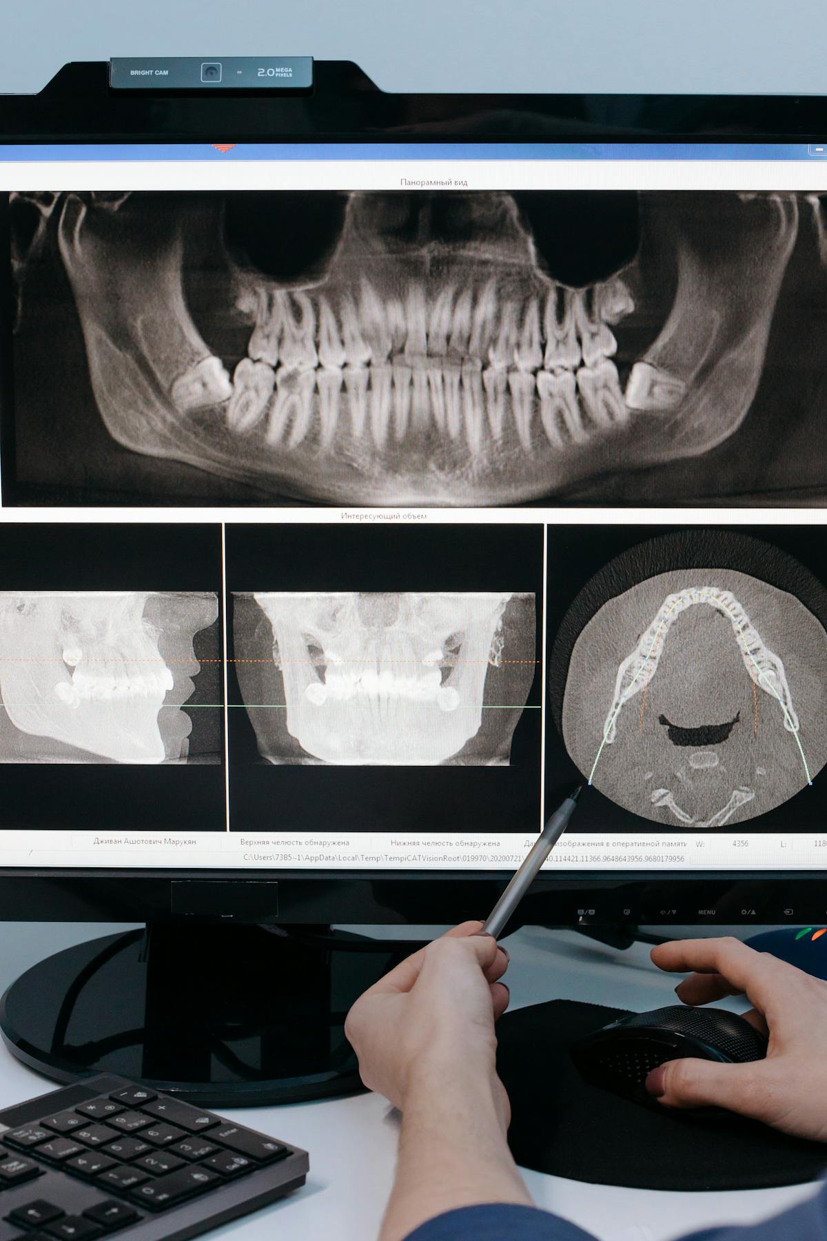 Indian dentist reviewing a panoramic dental X-ray on screen